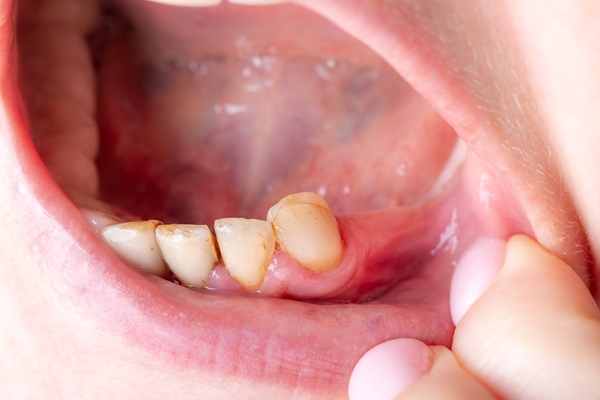 What Is Periodontics?